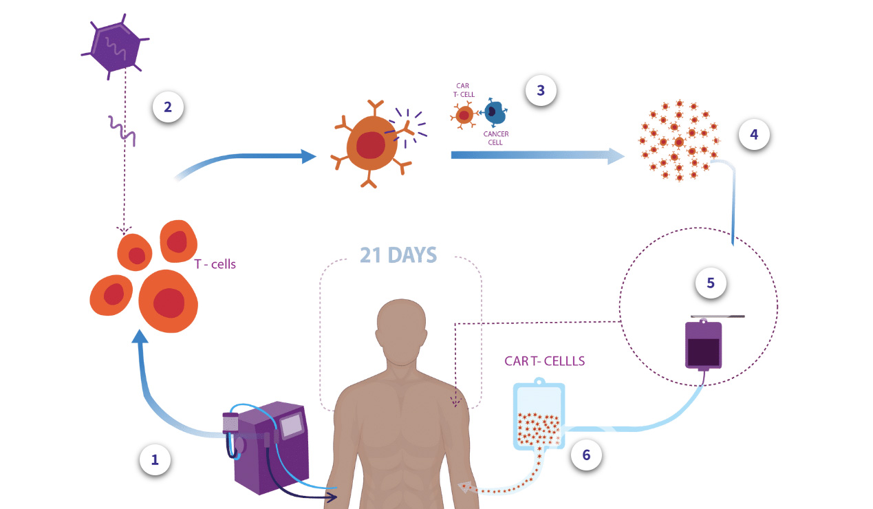 Immune Effector Cell (IEC) Therapy